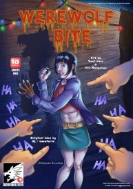 Werewolf Bite #1